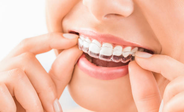 Best Doctor for Braces and Aligners in Nityanand Nagar,Ghatkopar